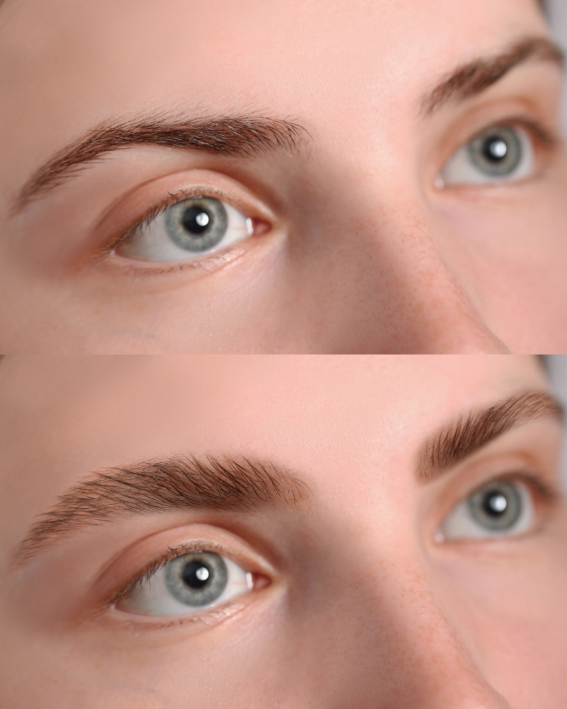 Before and after microblading results in Dubai