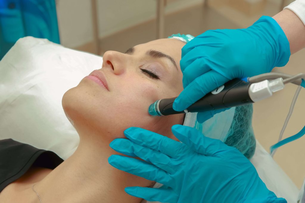 Hydrafacial in Dubai treatment being performed on a client's cheek